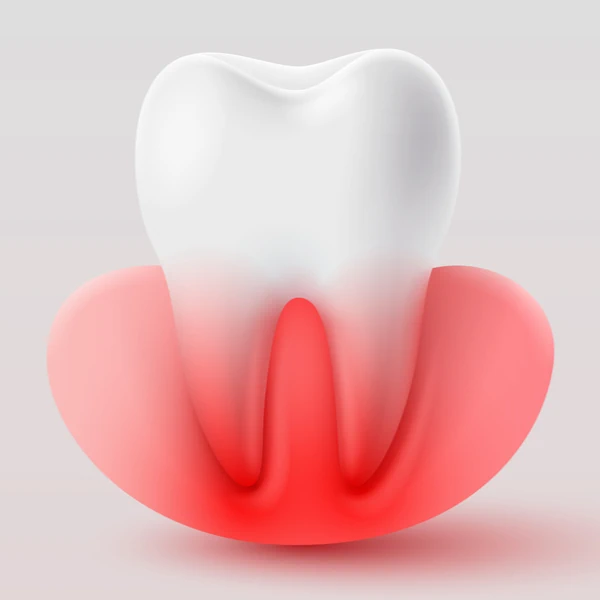 Zdravlje počinje od desni